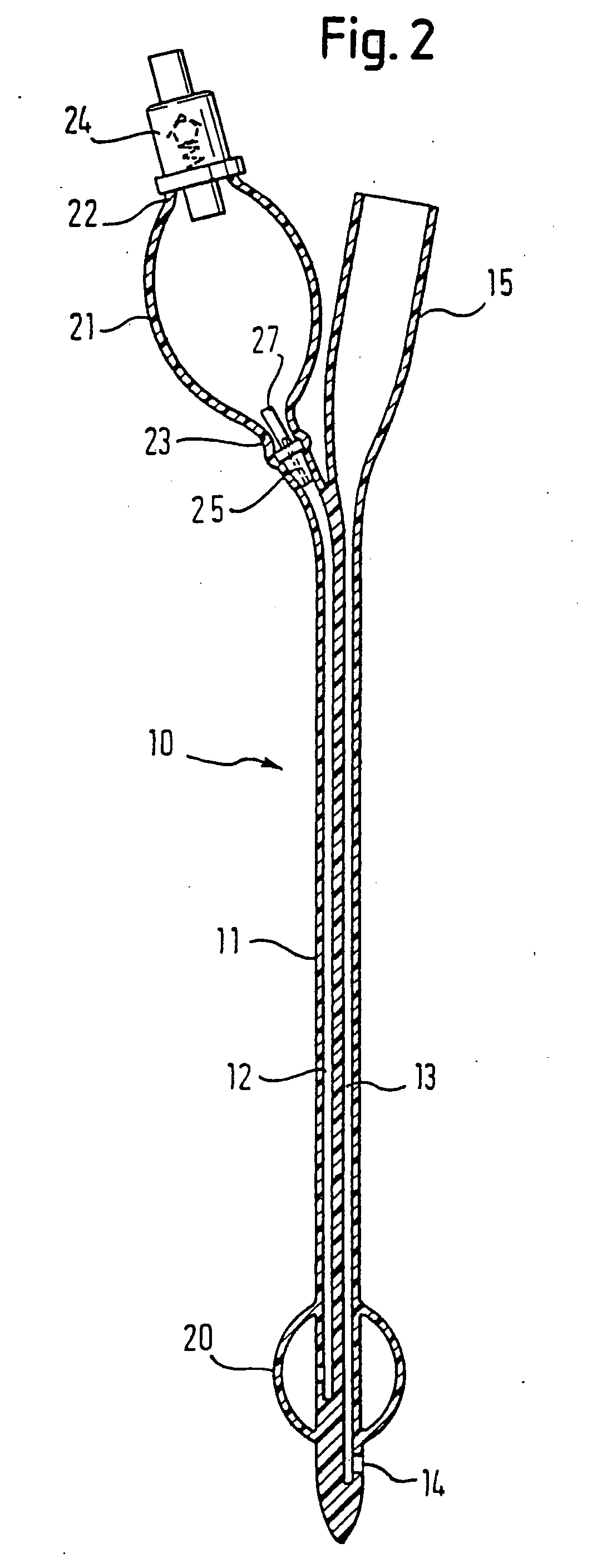 Medical device with elastomeric bulb