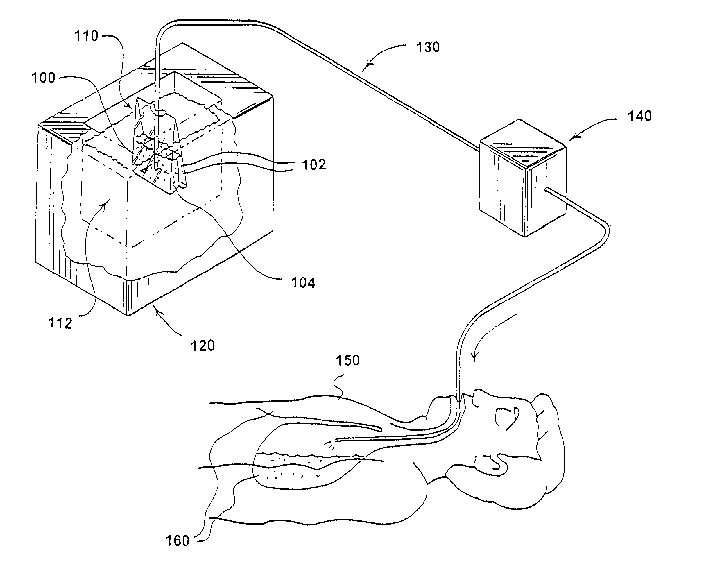 Method for inducing hypothermia