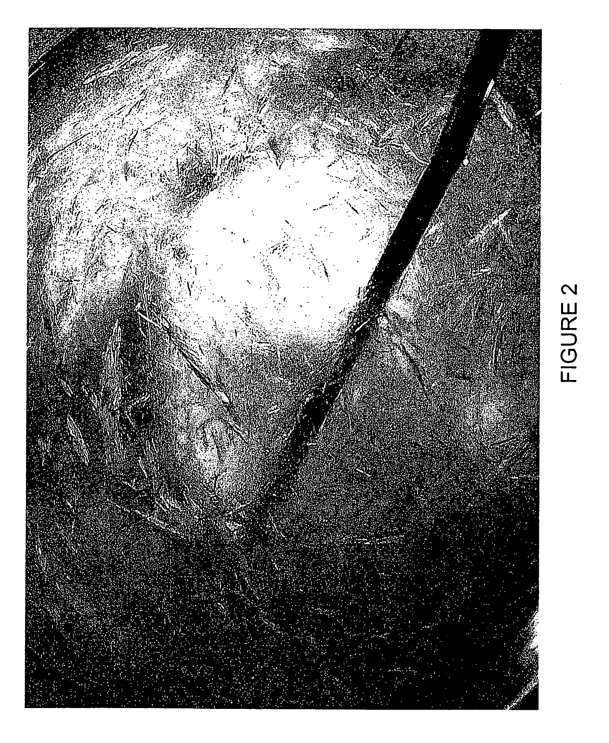 Method for inducing hypothermia