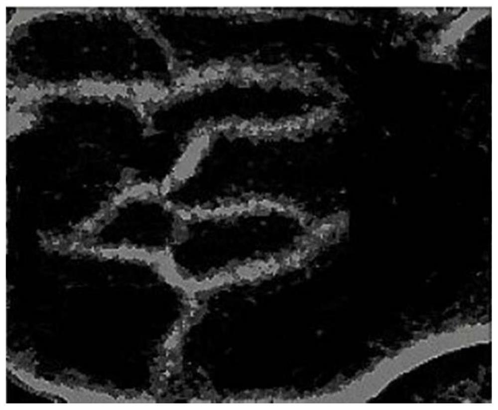 Ultrasonic image blood vessel bifurcation detection method