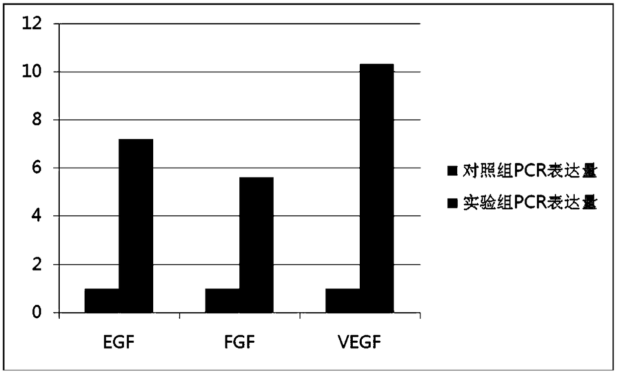 Sustained-release microsphere containing exosomes of mesenchymal stem cells and preparation method thereof