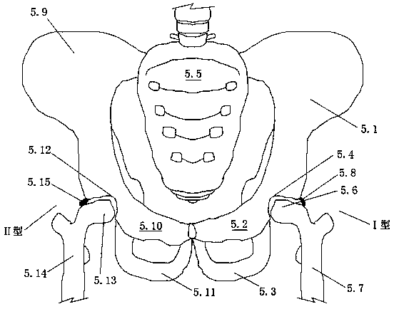 Humanoid model for ultrasonic examination of hip joints, production method of humanoid model and application of humanoid model