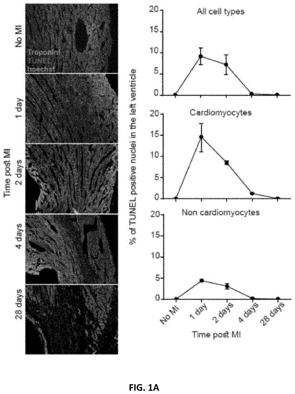 Modrna encoding sphingolipid-metabolizing proteins