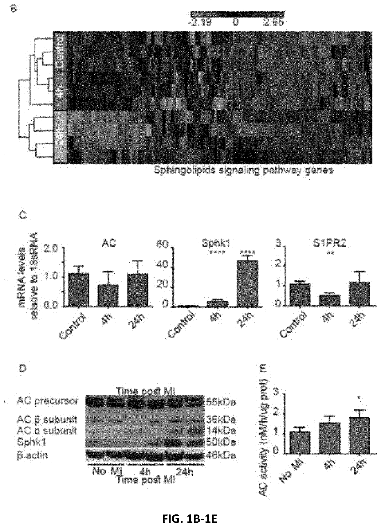 Modrna encoding sphingolipid-metabolizing proteins