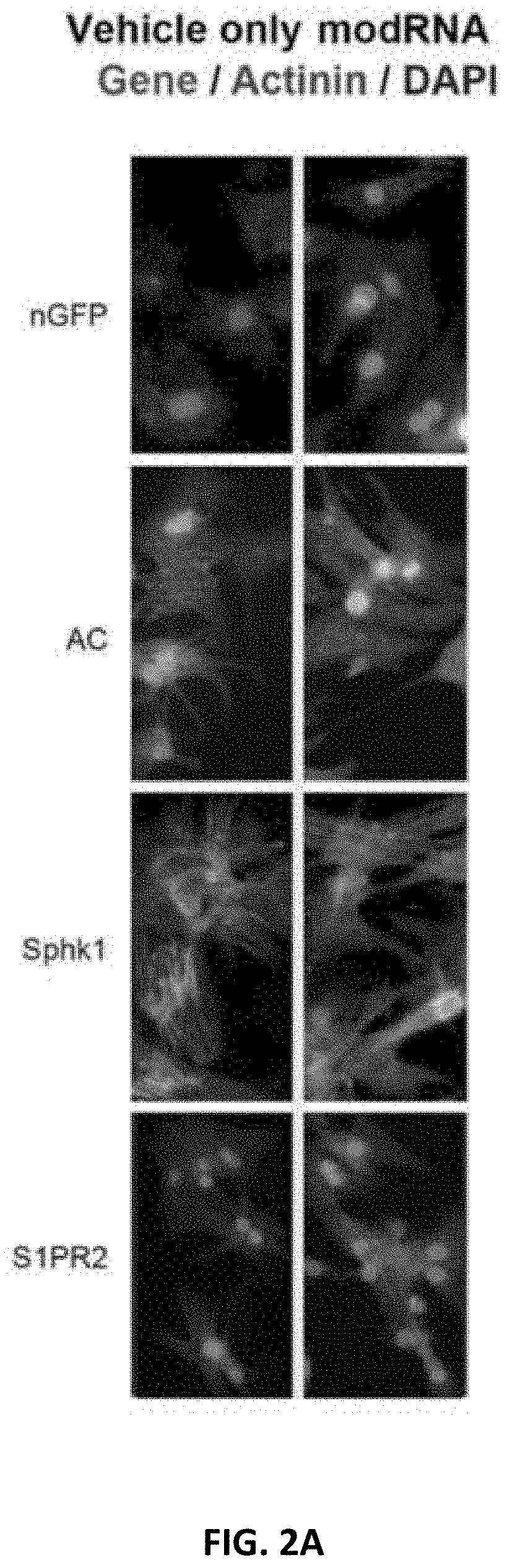 Modrna encoding sphingolipid-metabolizing proteins