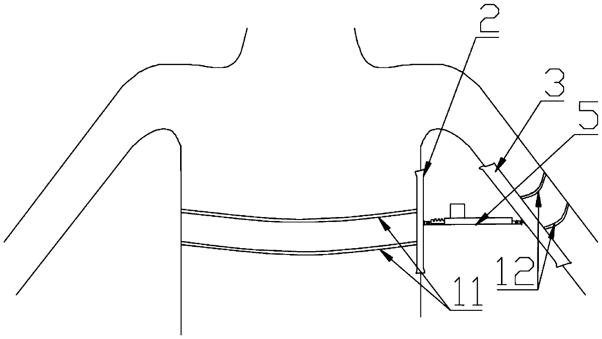 Shoulder joint fixing frame