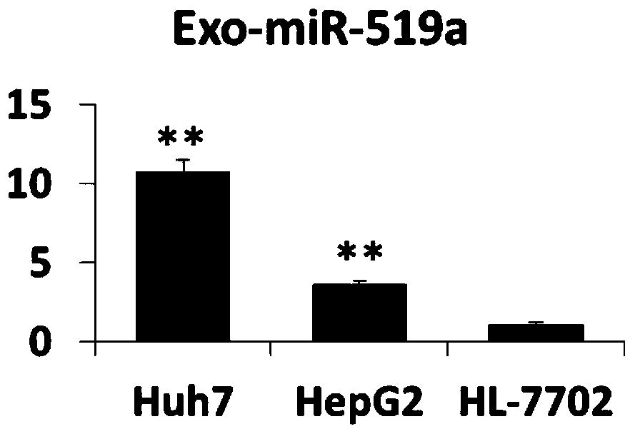 Blood exosome molecular marker and application thereof in preparation of liver cancer diagnostic products