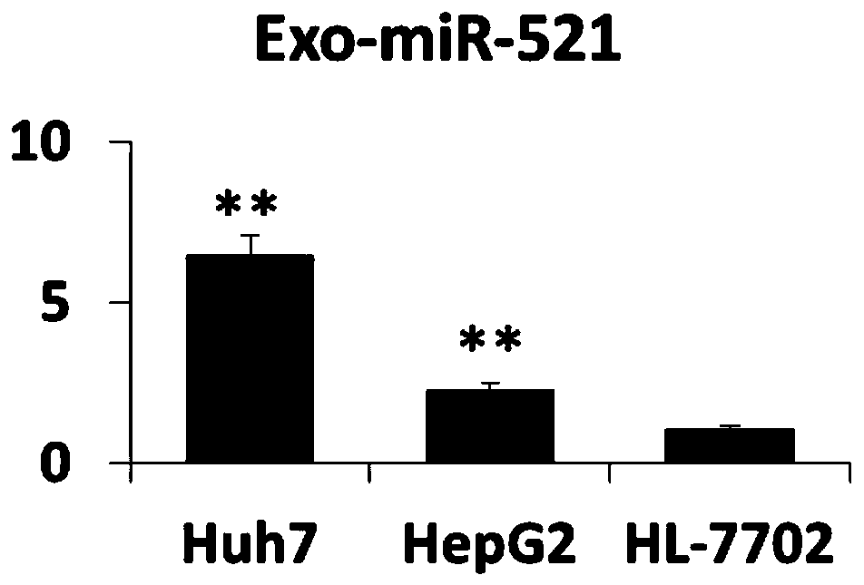 Blood exosome molecular marker and application thereof in preparation of liver cancer diagnostic products