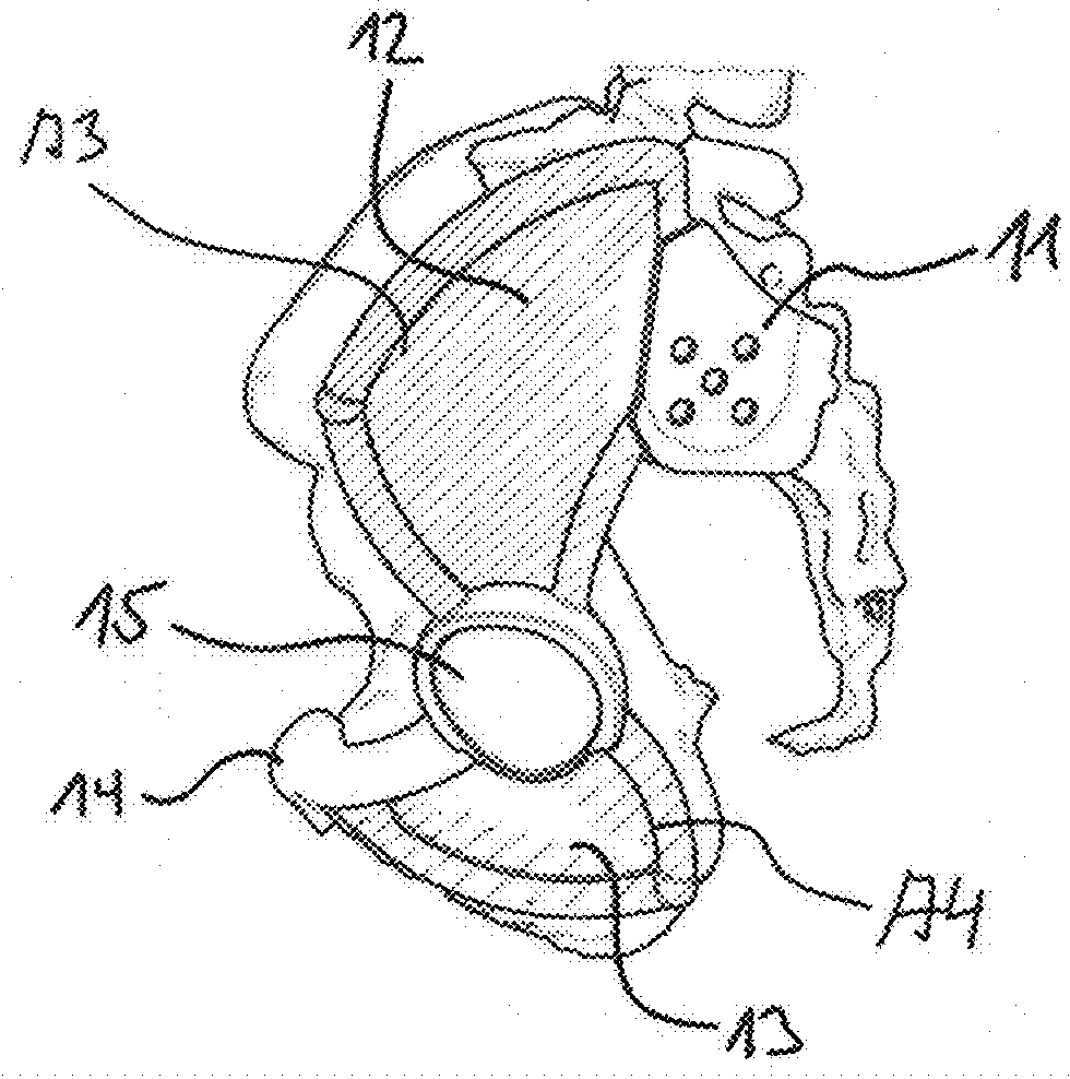 Coating for an implant