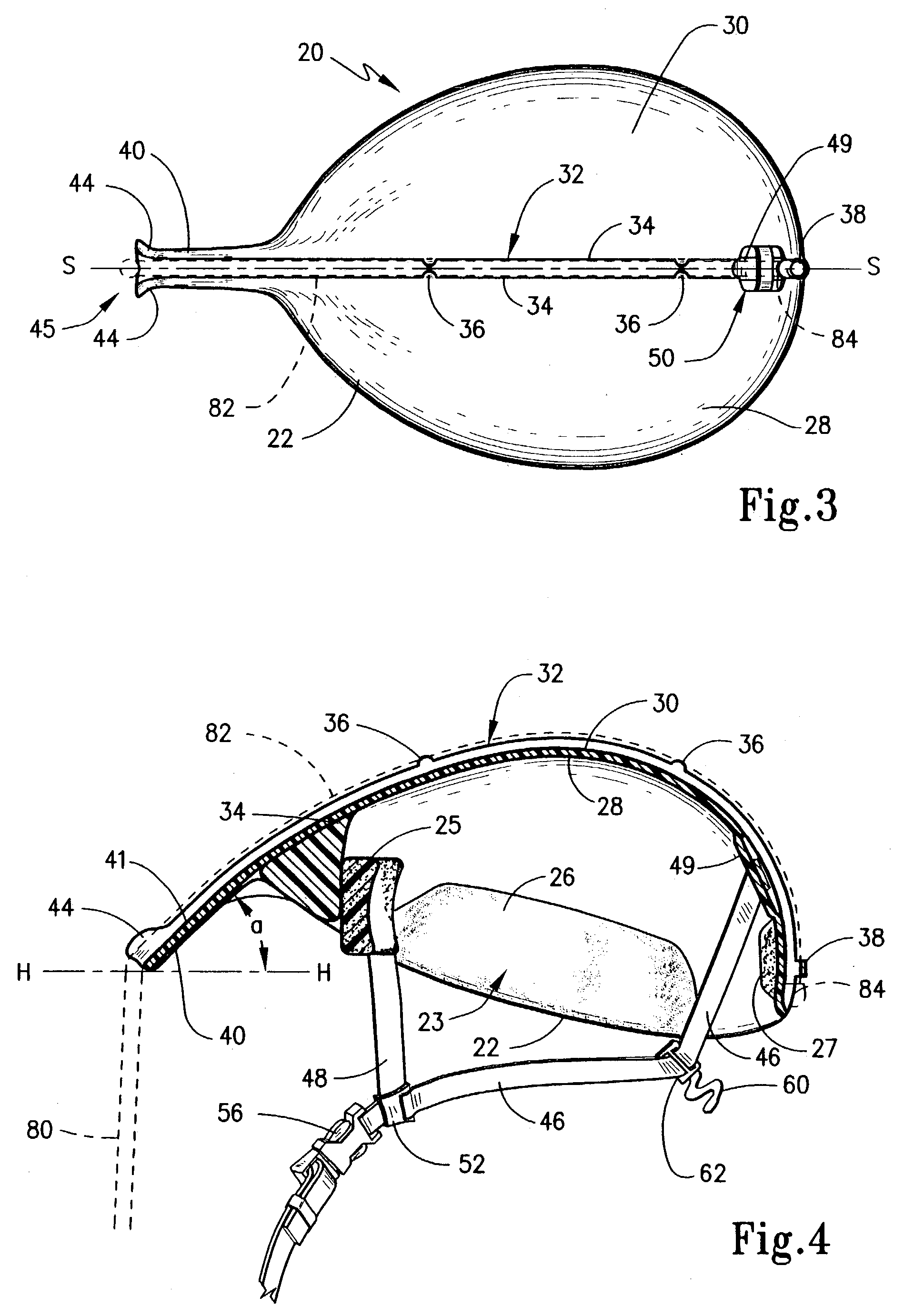 Therapeutic exercising apparatus and the method for the neck