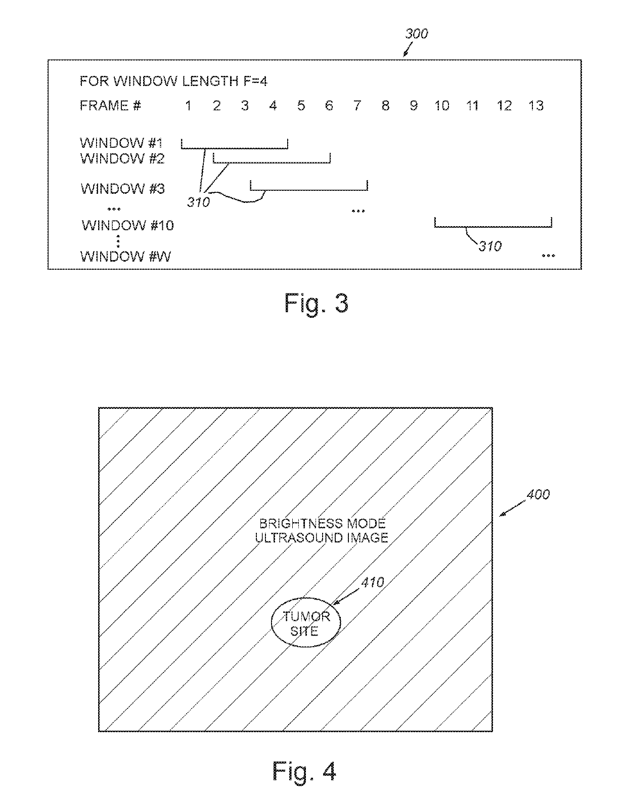 System and method for guiding invasive medical treatment procedures based upon enhanced contrast-mode ultrasound imaging