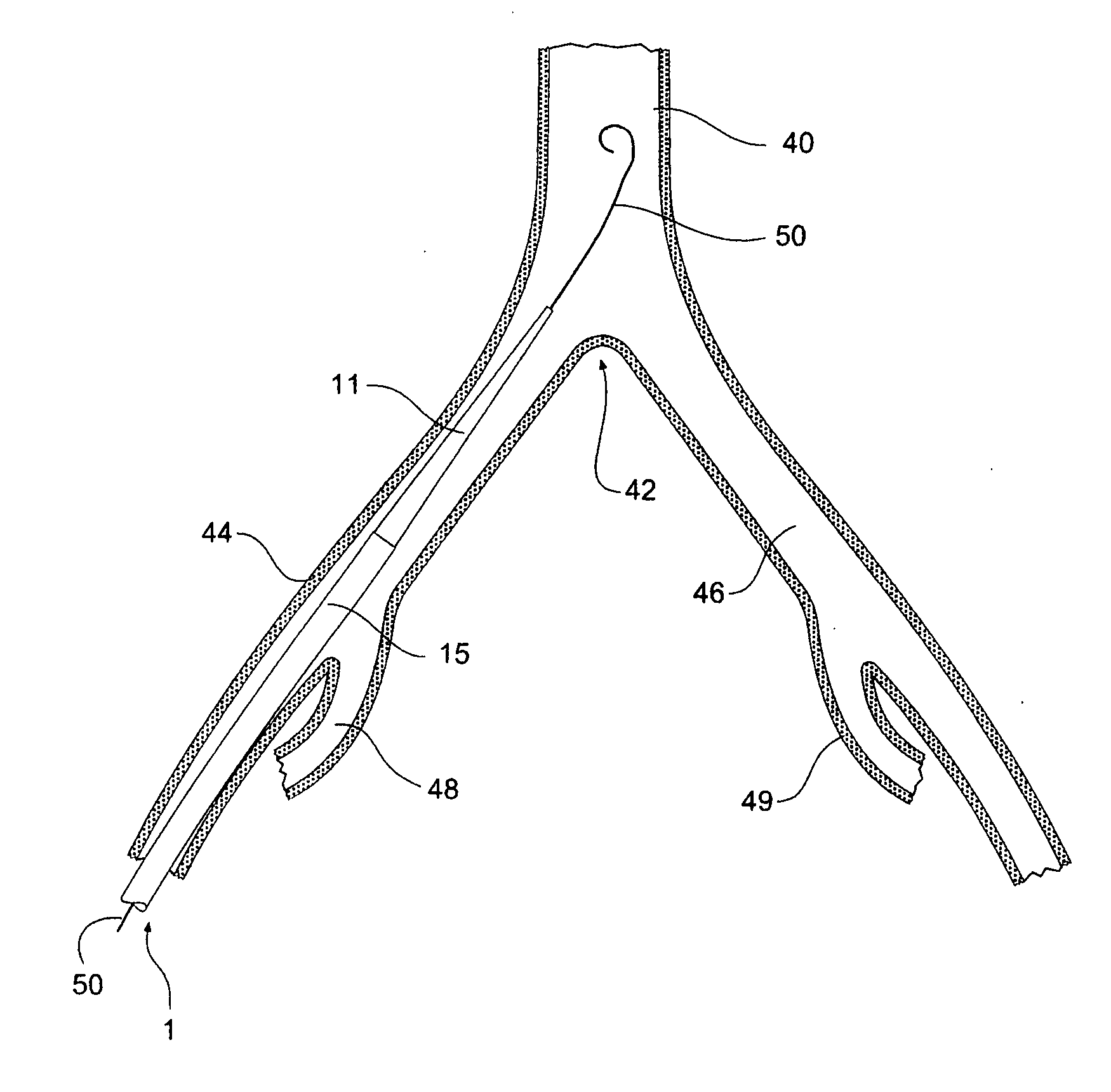 Introducer for a side branch device