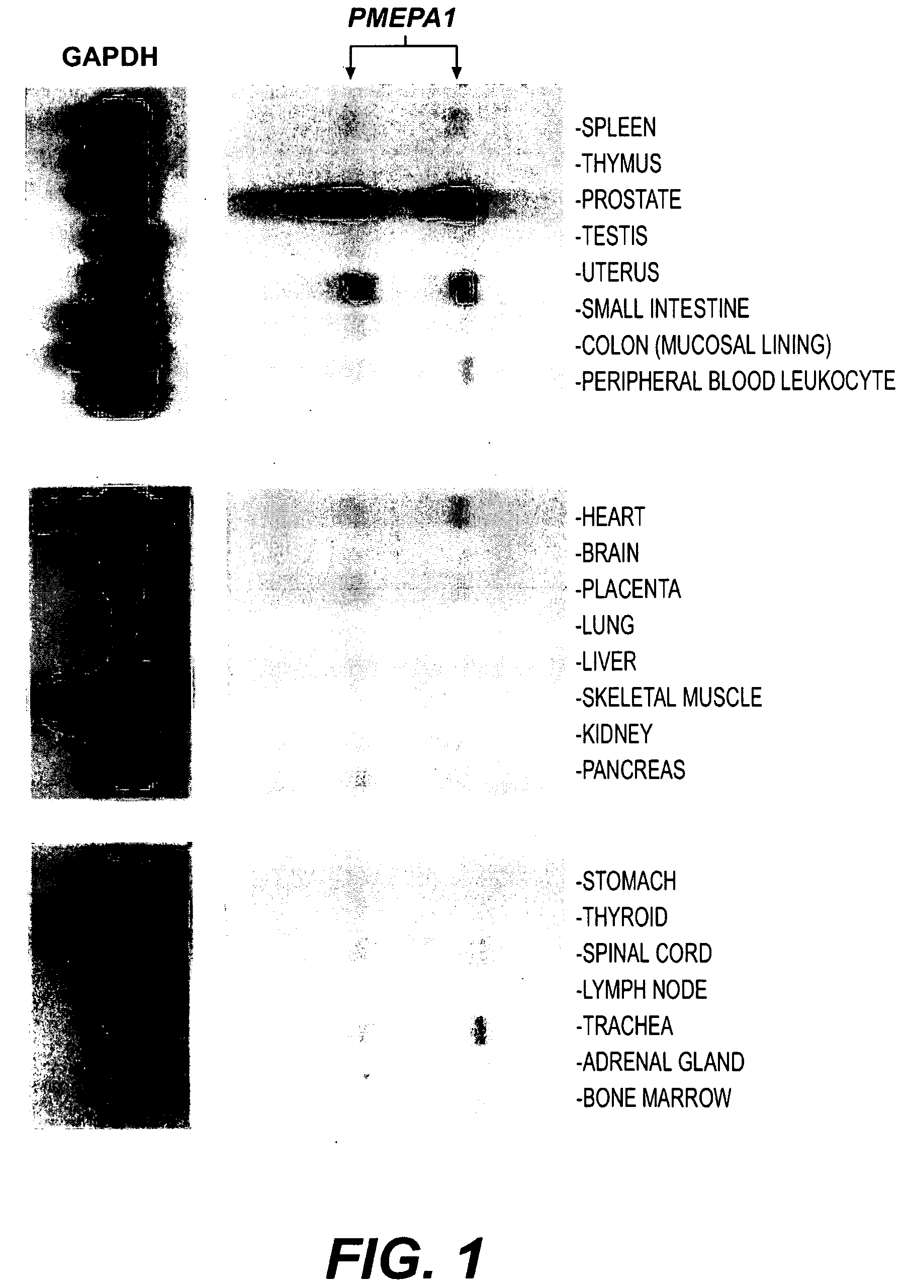 Androgen-regulated PMEPA1 gene and polypeptides