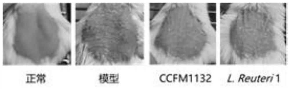 A strain of Lactobacillus reuteri capable of inhibiting the thickening of the cuticle of the skin and its application