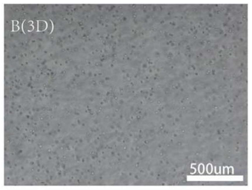 Dental pulp stem cell exosome as well as preparation method and application thereof