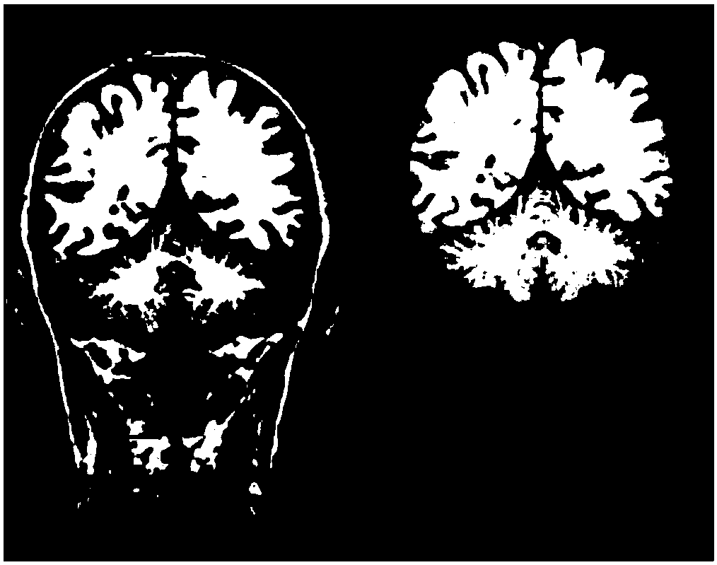 A Method for Fornix White Matter Segmentation Based on Fusion of fMRI and DTI