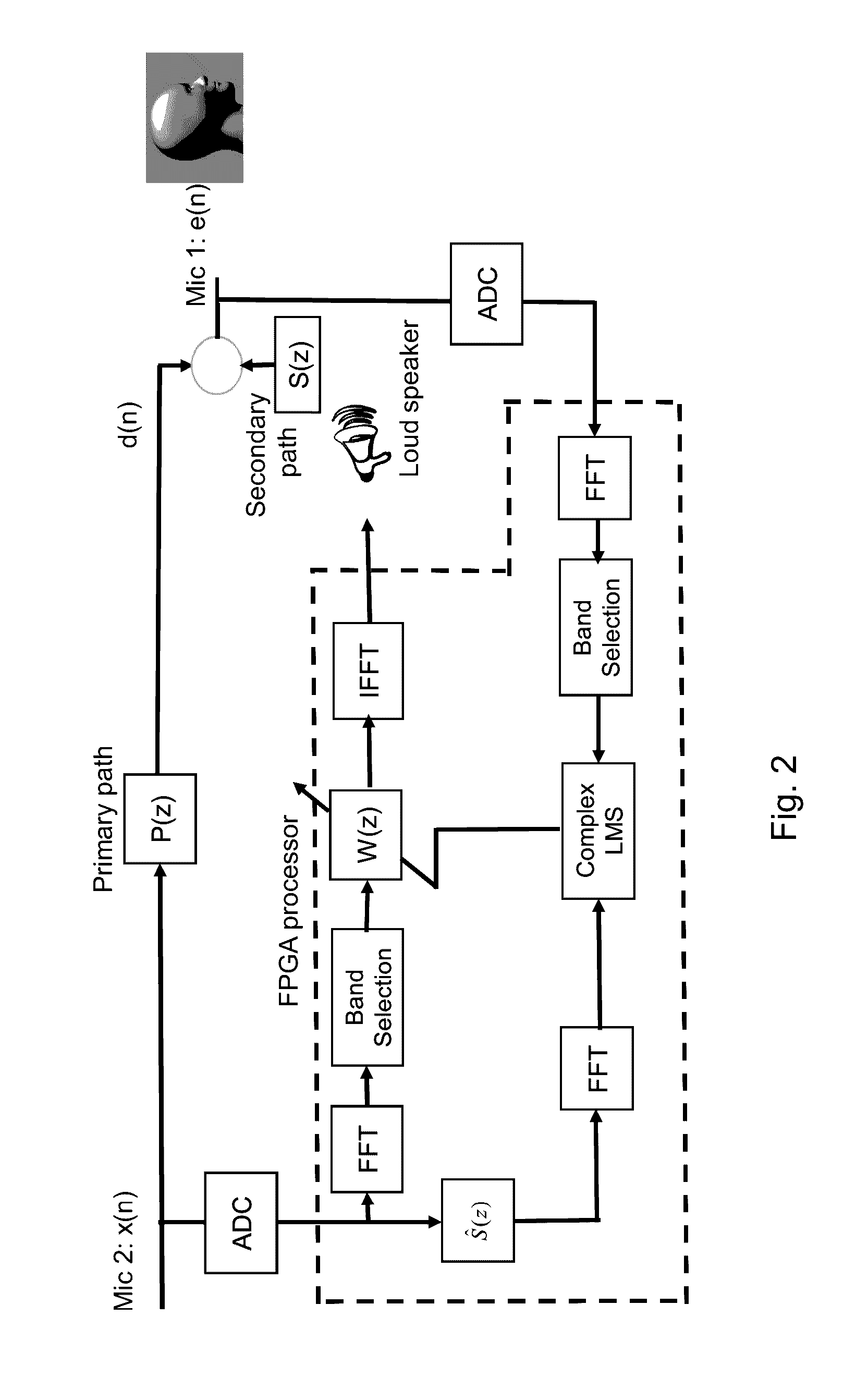 Active Noise Reduction System for Creating a Quiet Zone