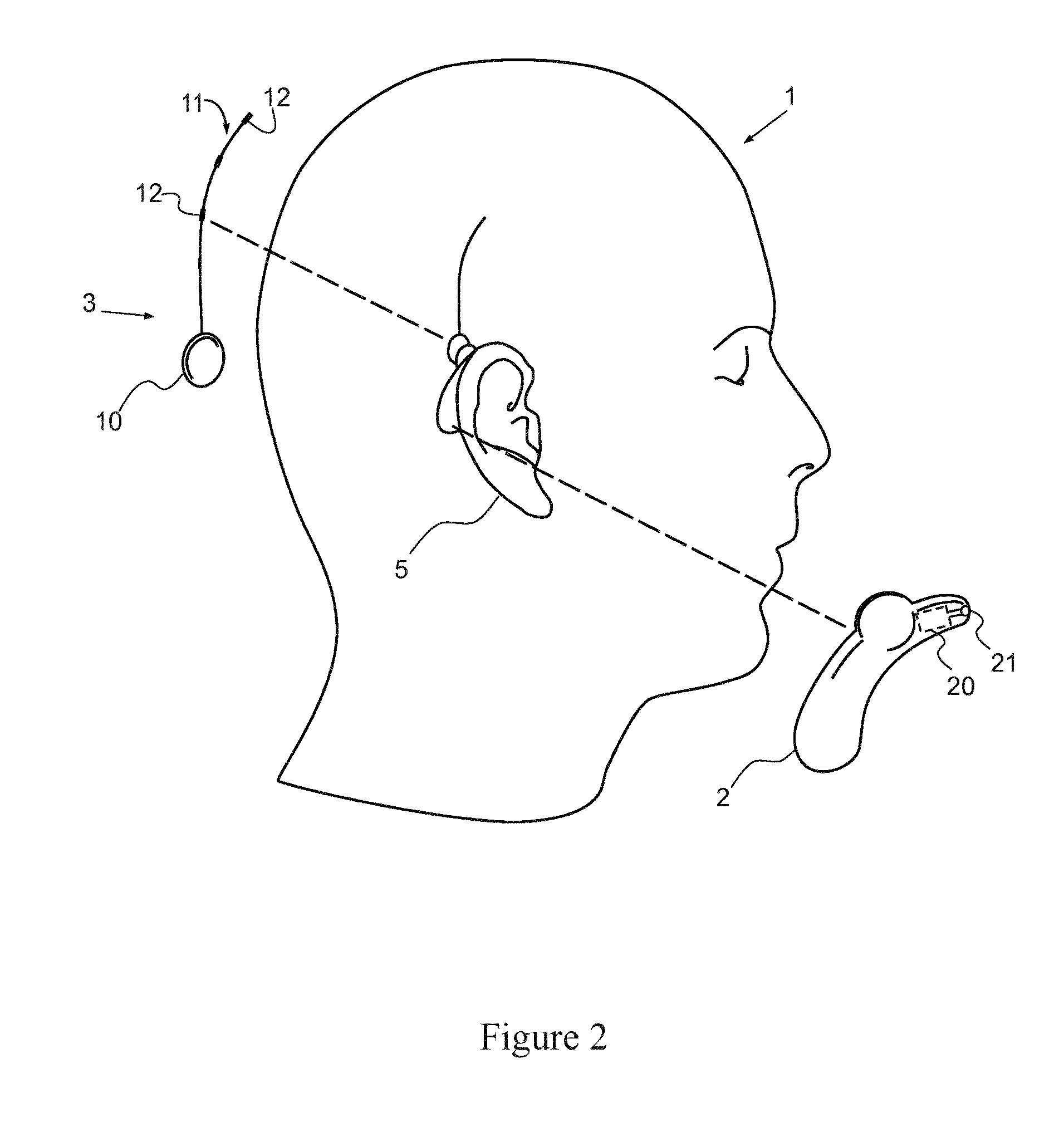 Bio-electrical signal monitor with two speakers