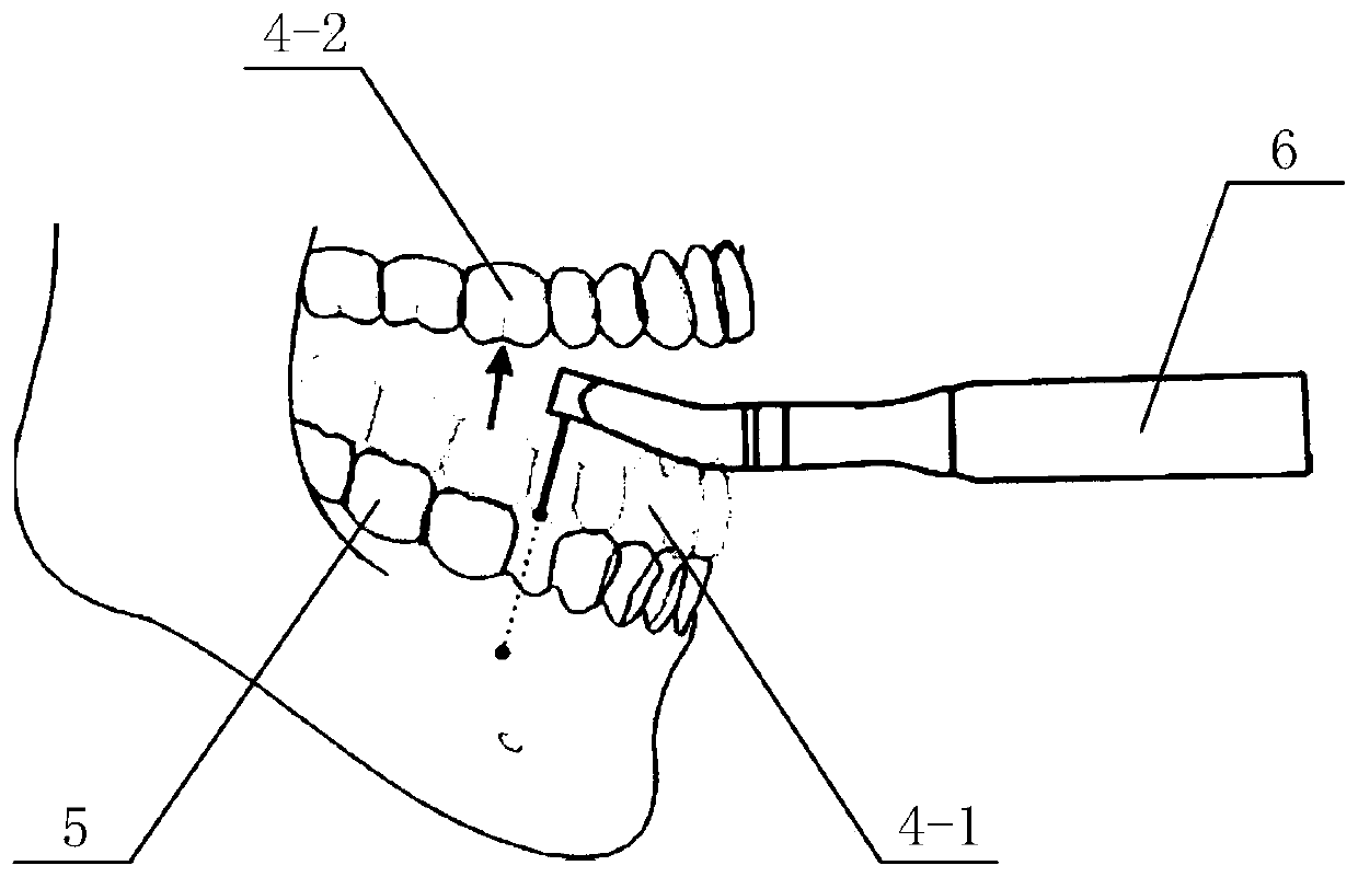 Positioning device for oral implant surgery and surgical path planning method