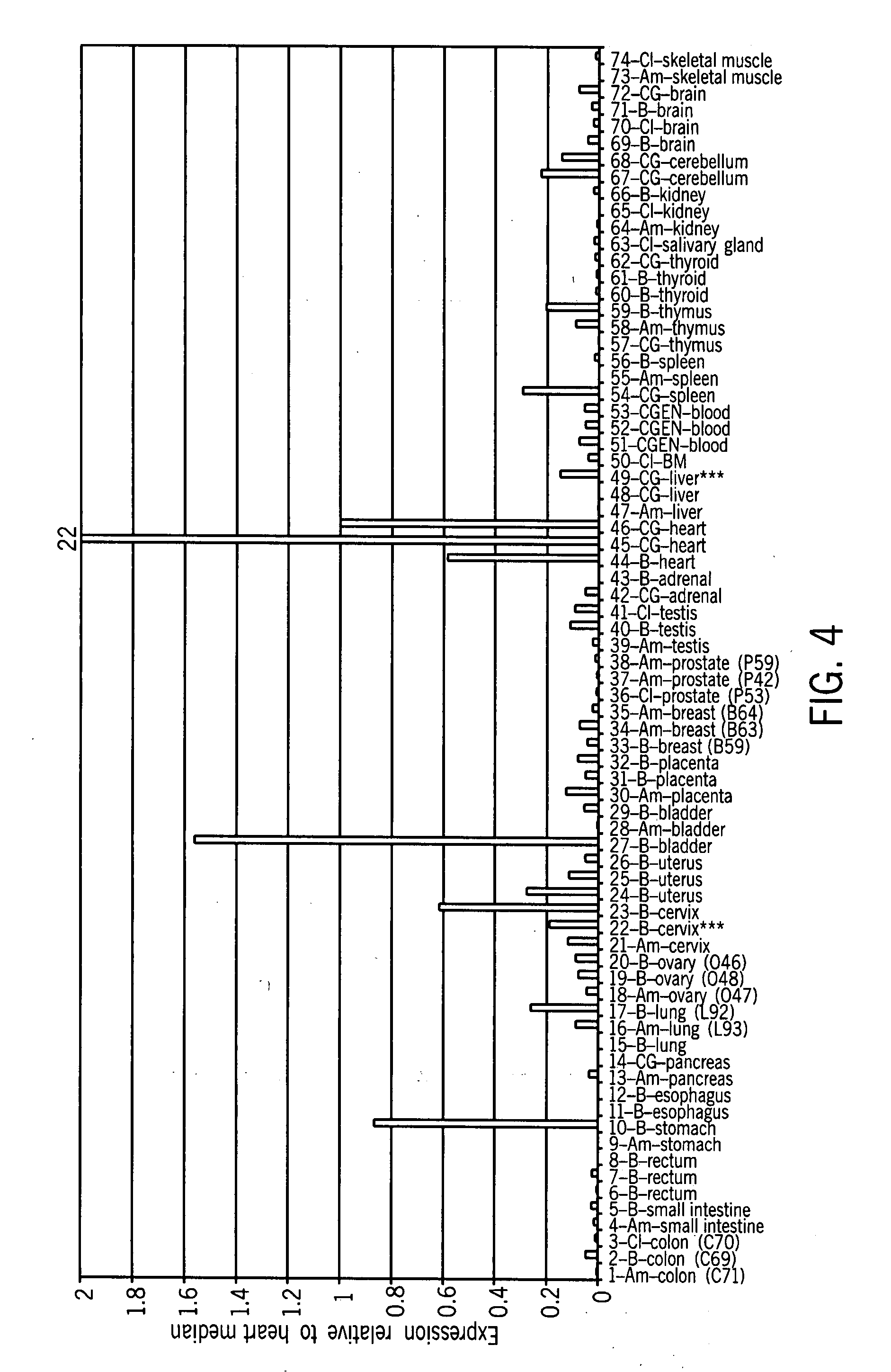 Novel brain natriuretic peptide variants and methods of use thereof