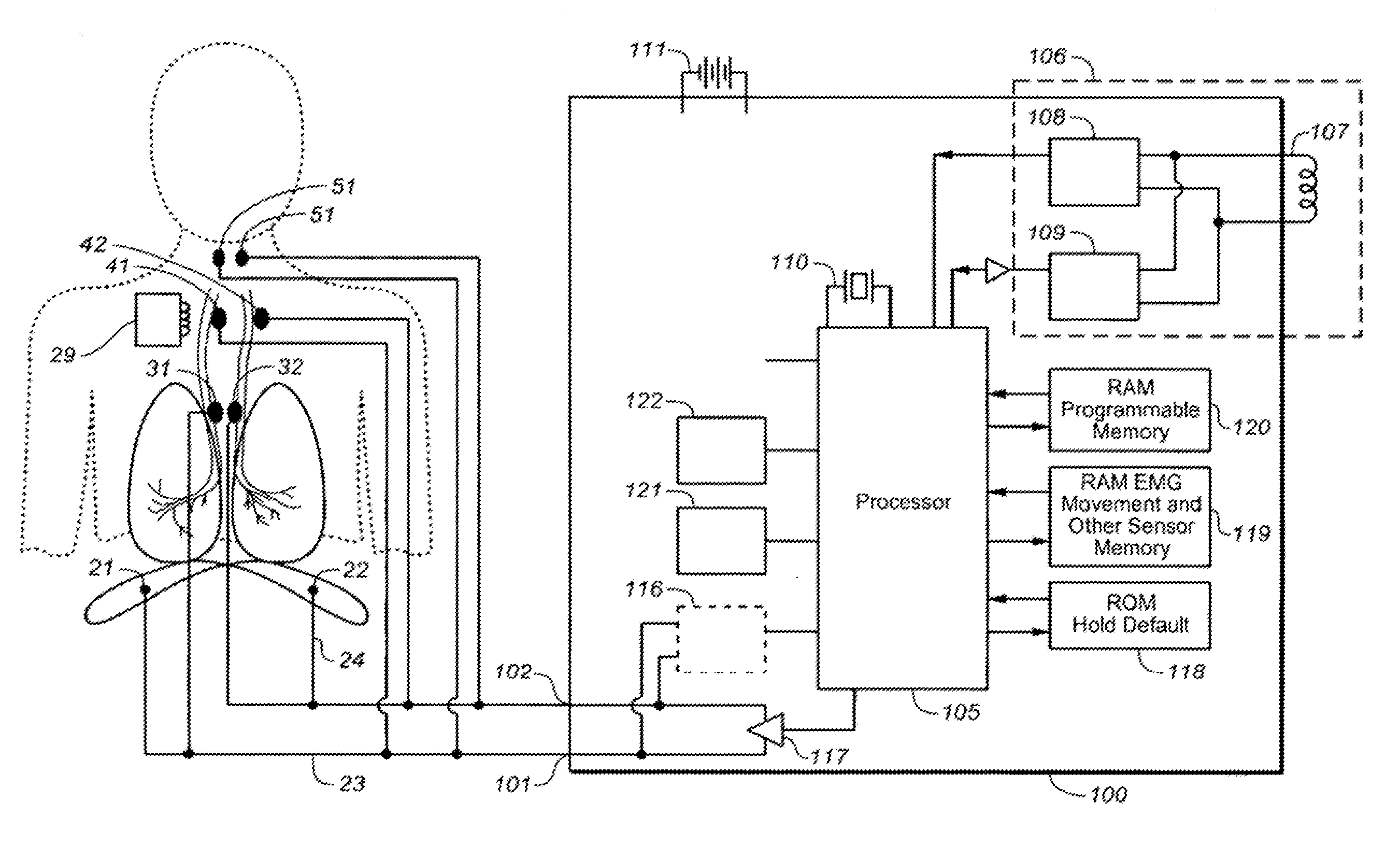 Therapeutic diaphragm stimulation device and method