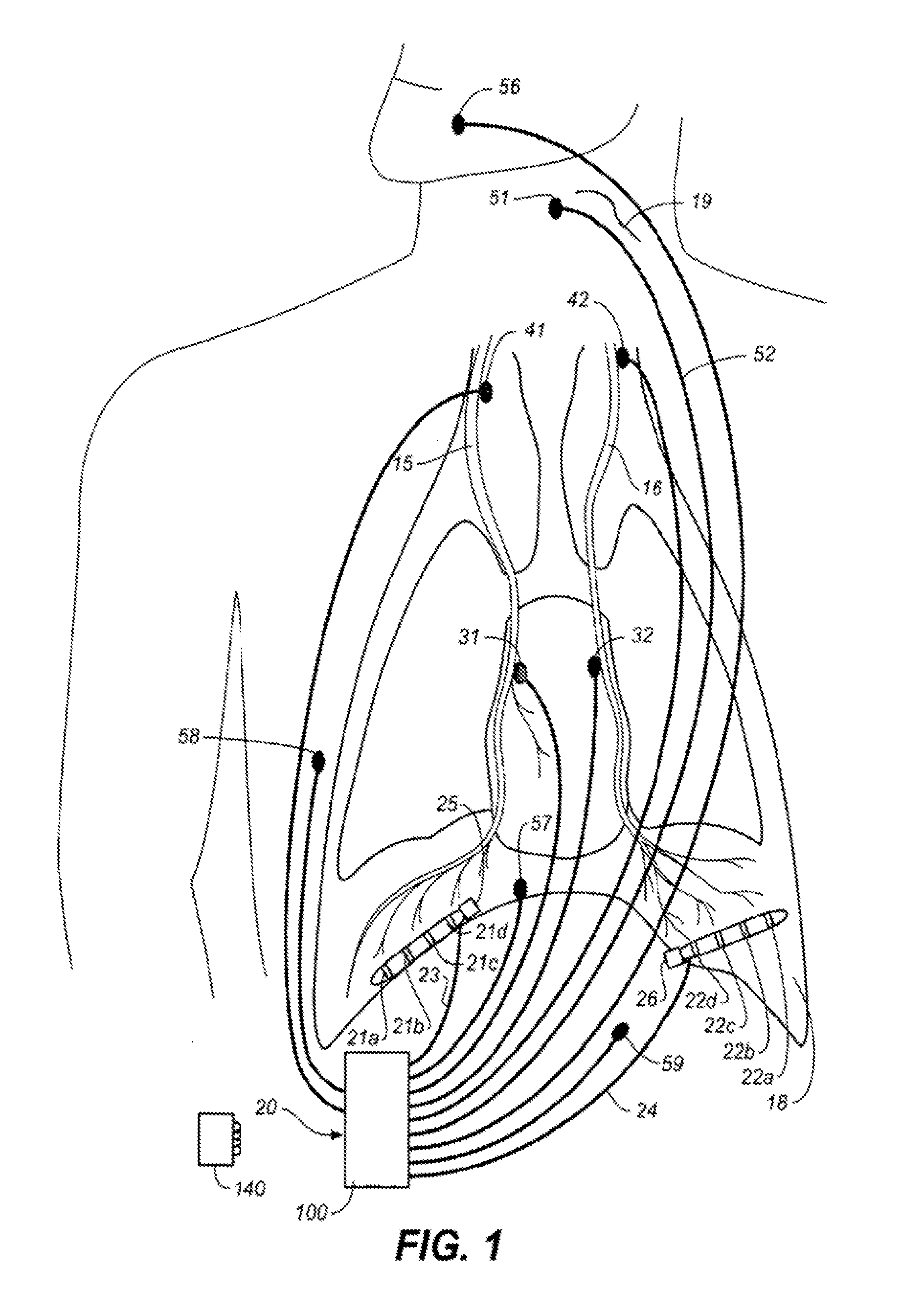 Therapeutic diaphragm stimulation device and method