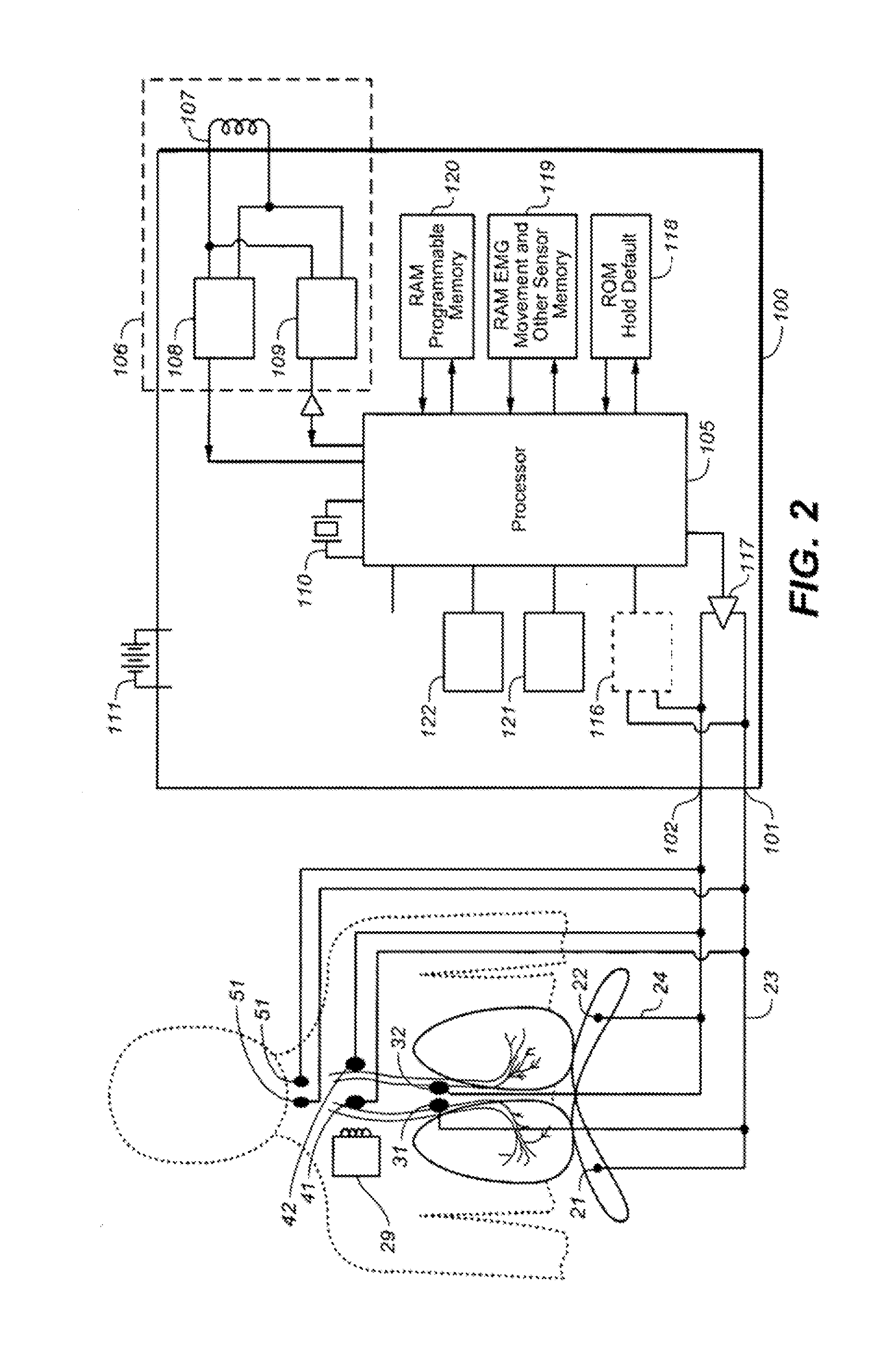 Therapeutic diaphragm stimulation device and method