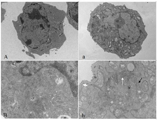 Method for rapidly detecting retrovirus by using cell ultrathin section electron microscope