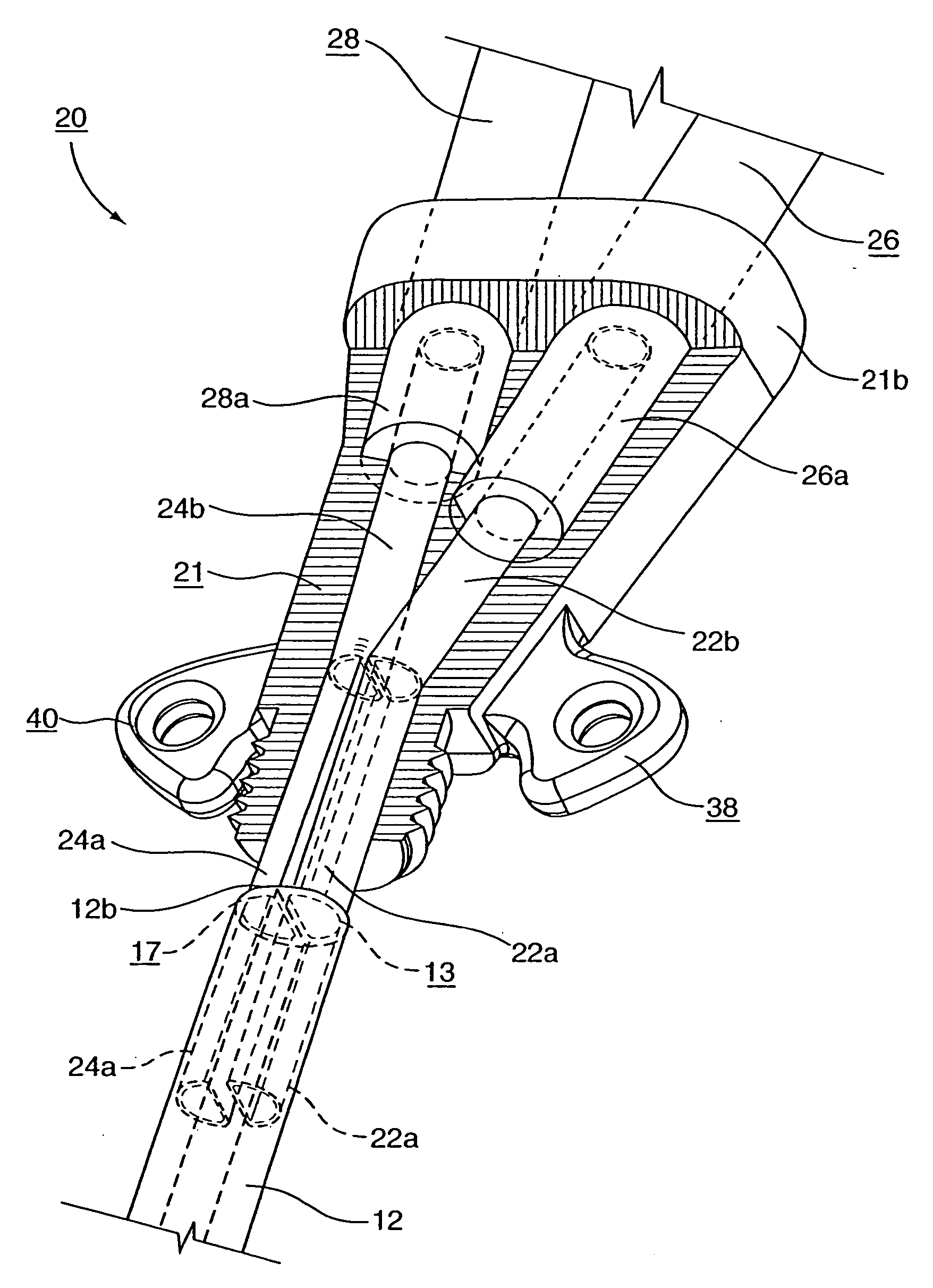 Multi-lumen catheter with attachable hub