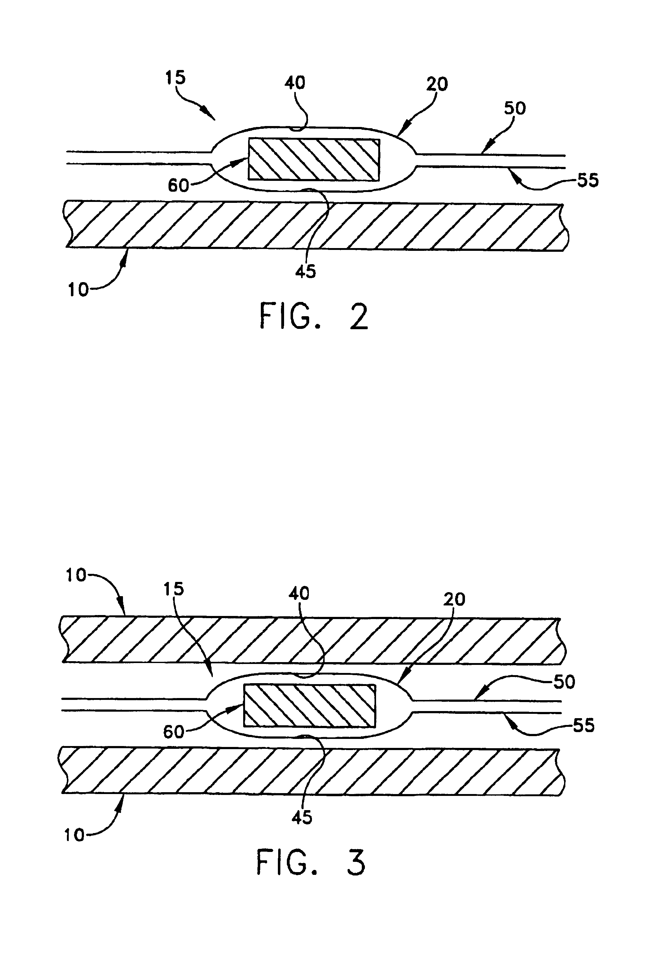 Personal cooling or warming system using closed loop fluid flow