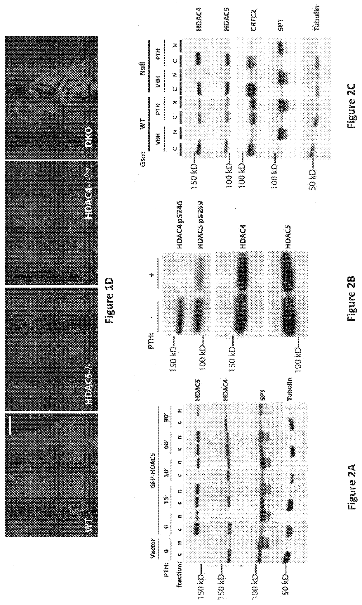 Uses of salt-inducible kinase (SIK) inhibitors for treating osteoporosis