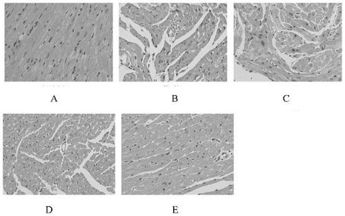 Application of miglitol to preparation of medicine for treating cardiovascular diseases