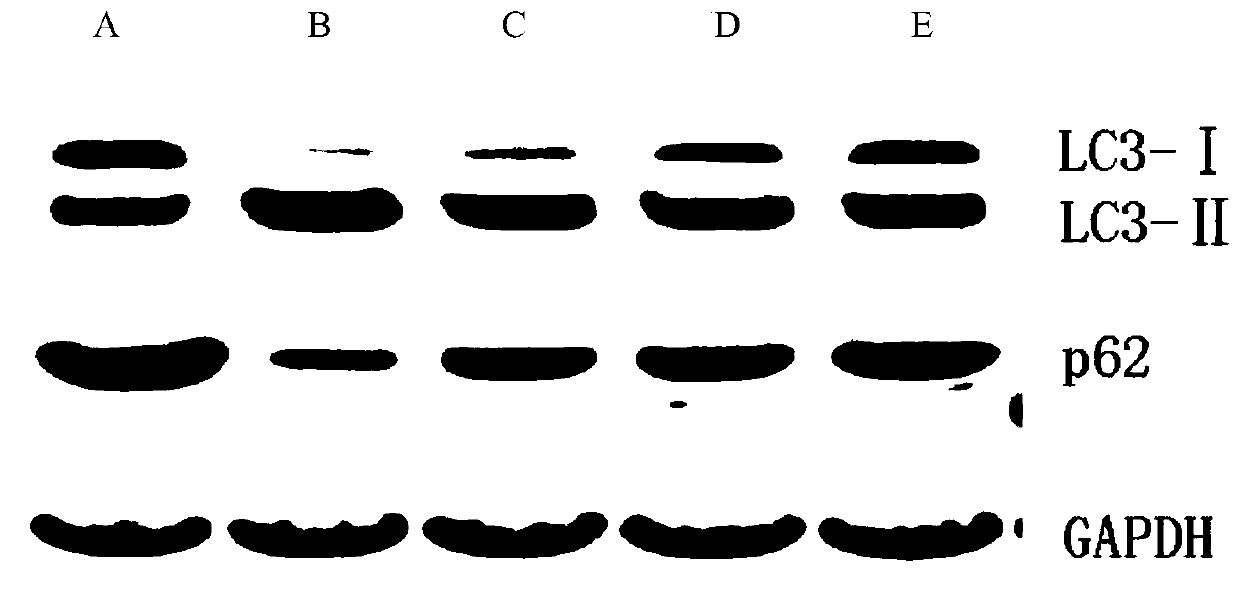 Application of miglitol to preparation of medicine for treating cardiovascular diseases