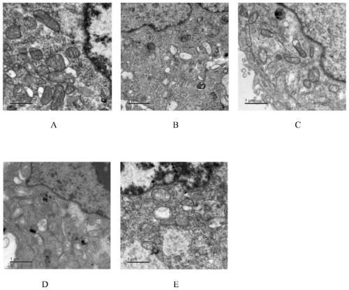 Application of miglitol to preparation of medicine for treating cardiovascular diseases