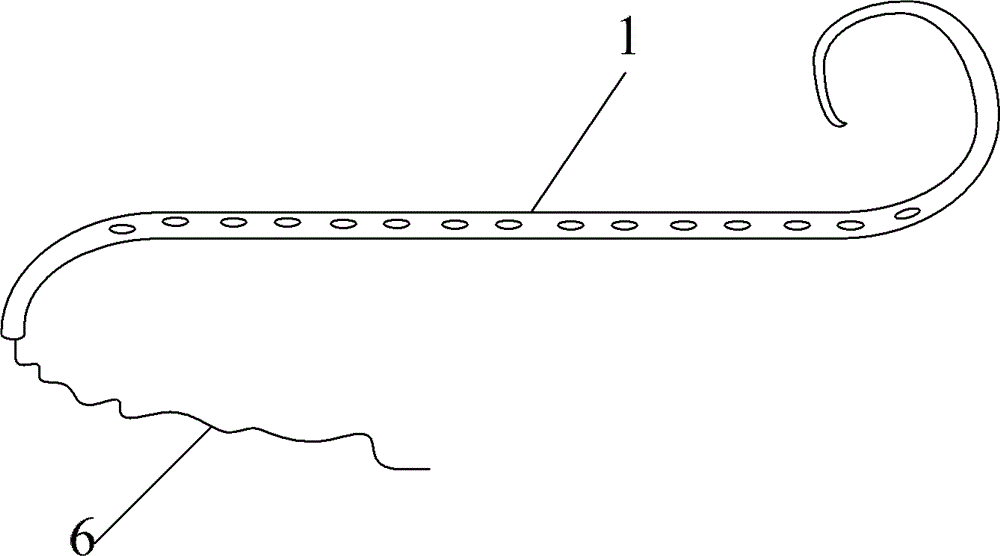 Ureteral stent