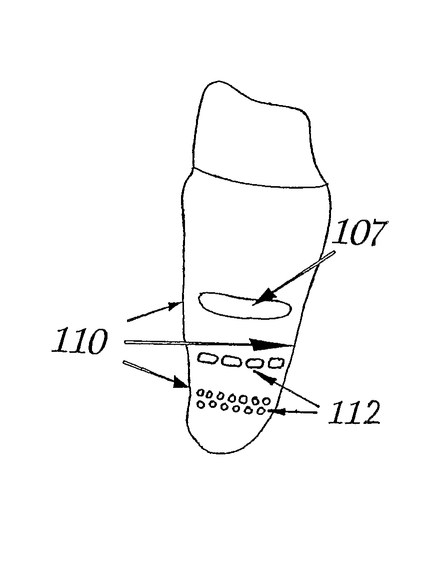 Tooth implant