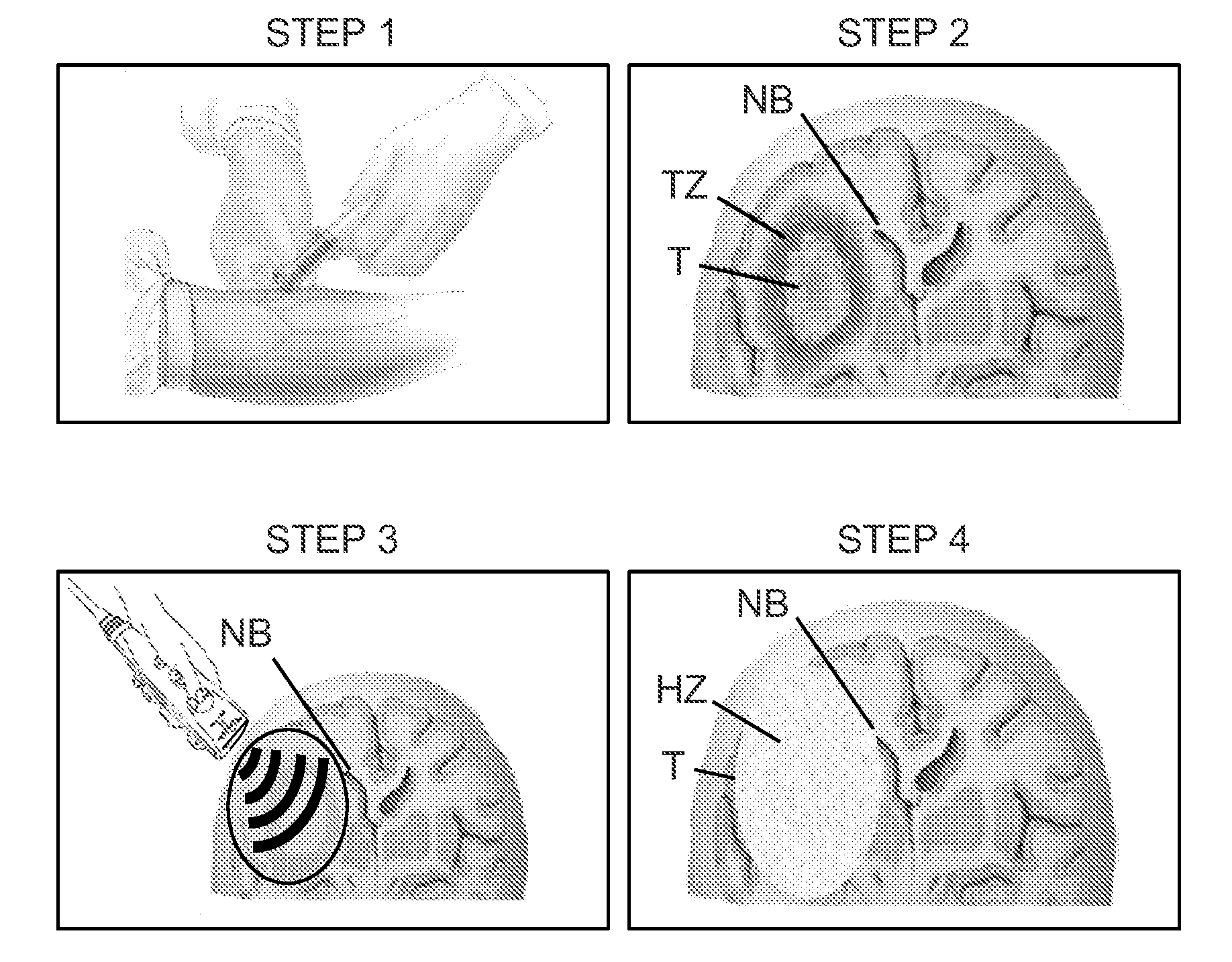 Methods for enhancing the delivery of active agents