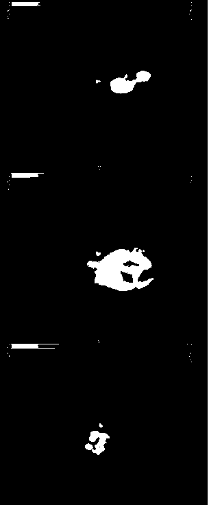 Preparation method of Cu-64 labeled Dimer-San A cyclic peptide derivative pancreatic cancer molecular probe