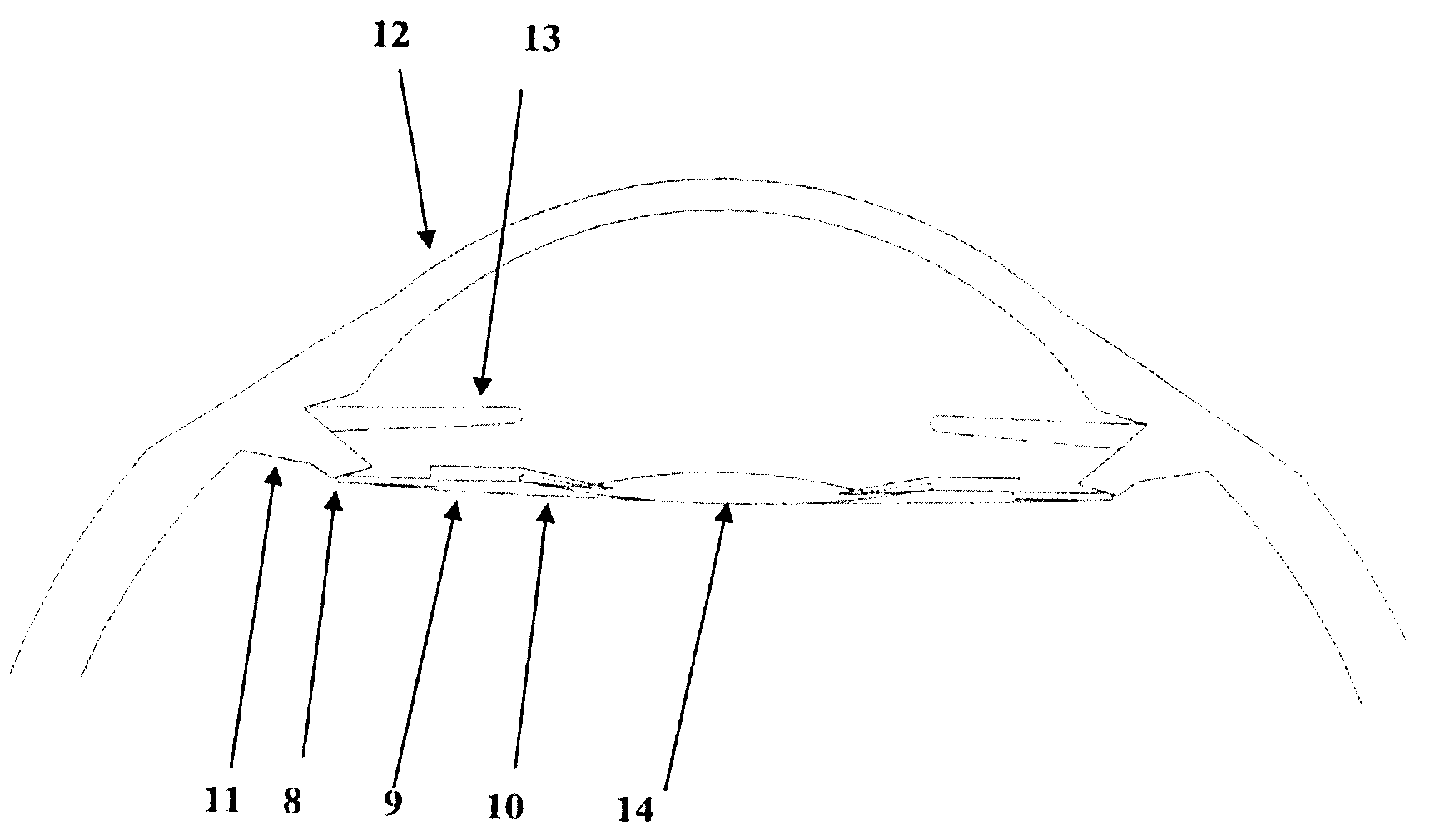 Intraocular lens optic