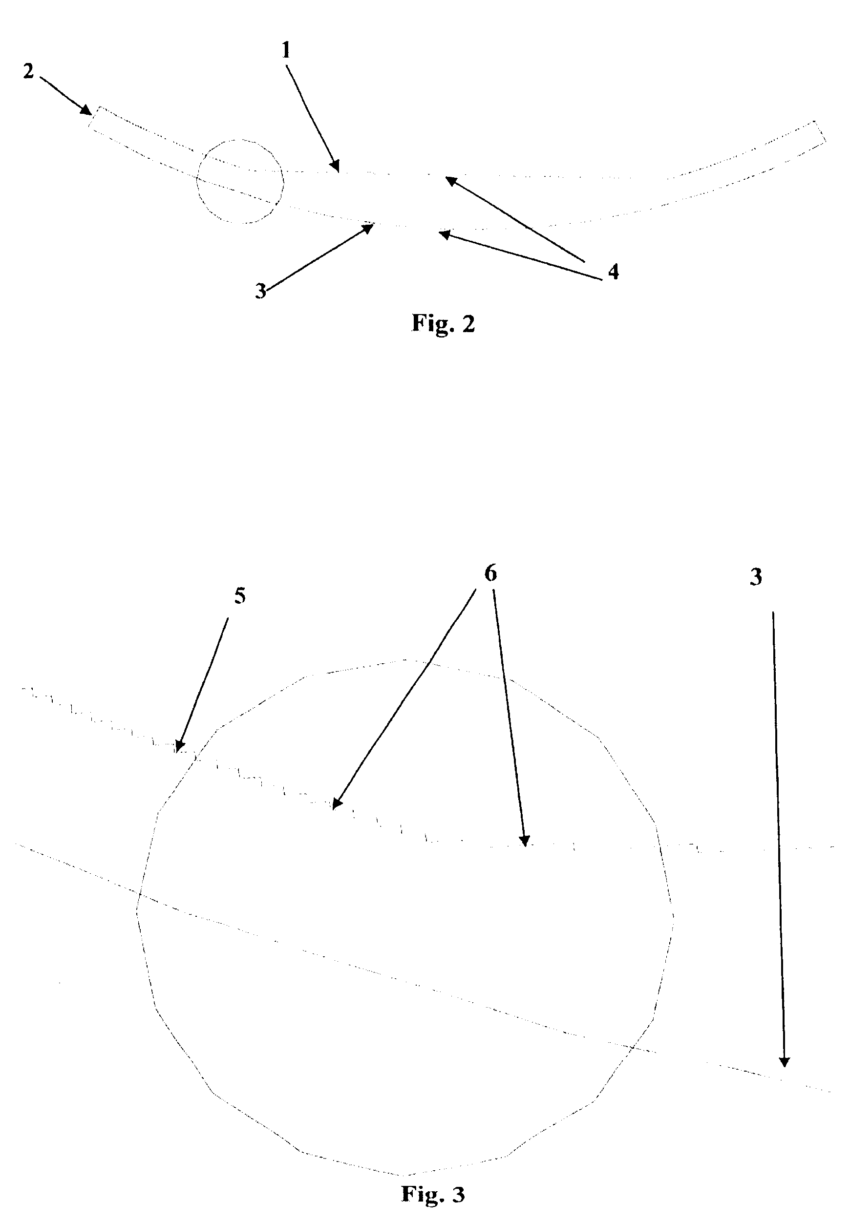 Intraocular lens optic