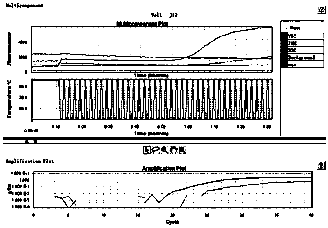 Method for predicting risk of non-alcoholic fatty liver disease by gene polymorphism