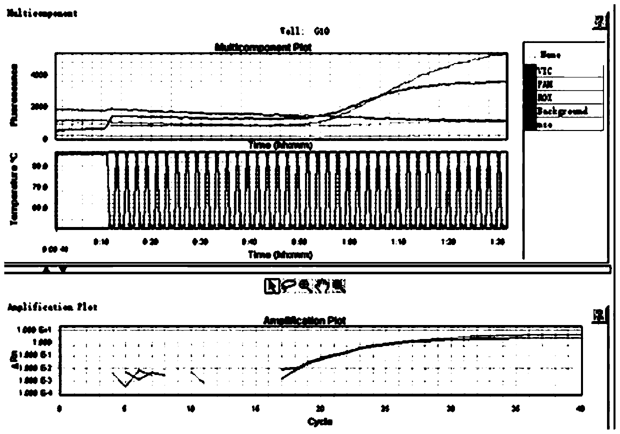 Method for predicting risk of non-alcoholic fatty liver disease by gene polymorphism