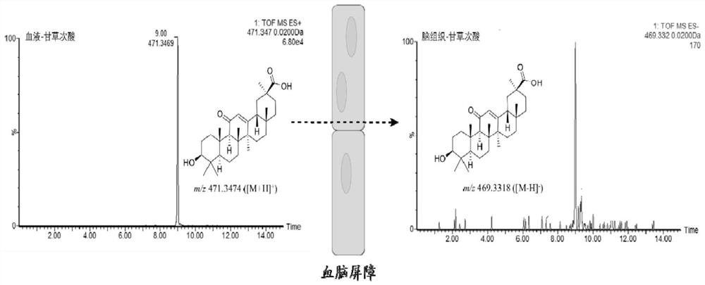 Application of 18 beta-glycyrrhetinic acid in preparation of depression-related neuronal protection medicine