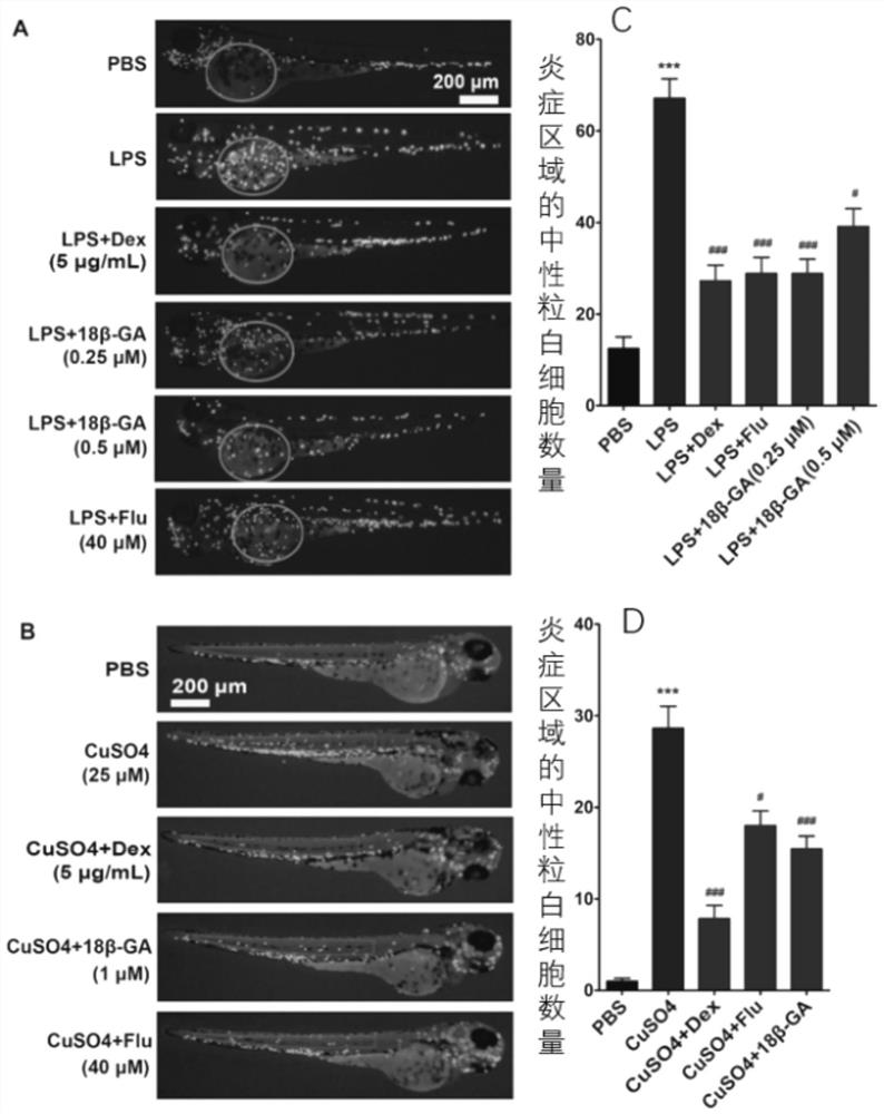 Application of 18 beta-glycyrrhetinic acid in preparation of depression-related neuronal protection medicine