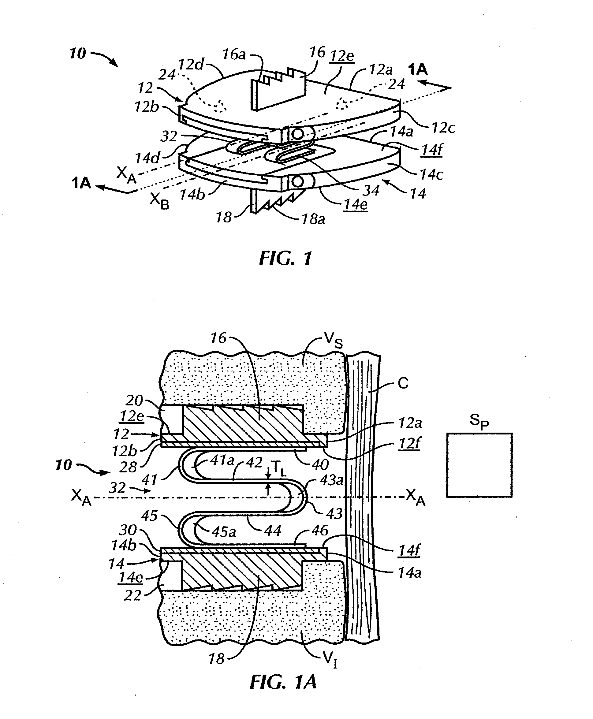 Total disc replacement with w-shaped spring elements