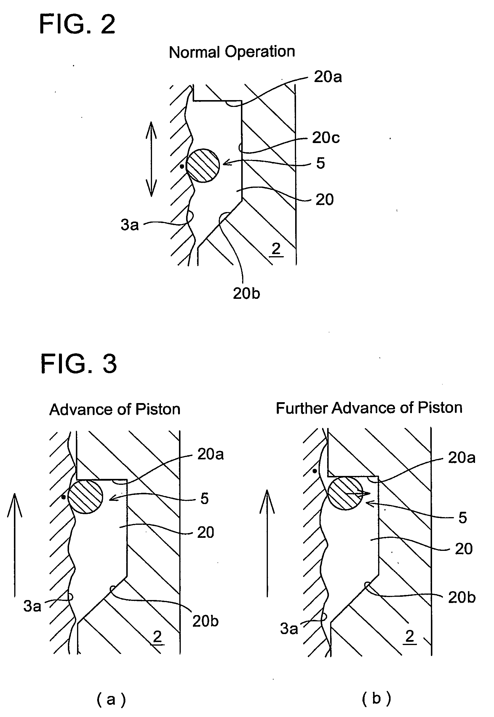 Tensioner