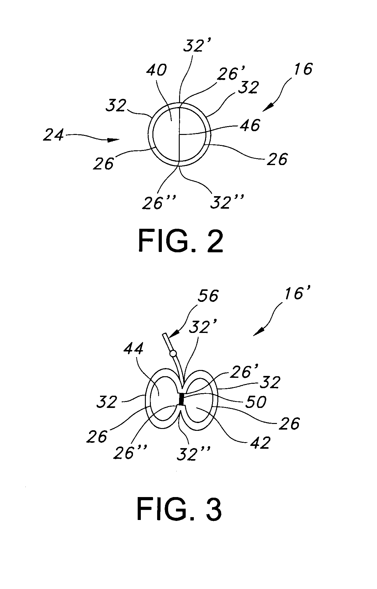 Methods of surgically modifying the duodenum