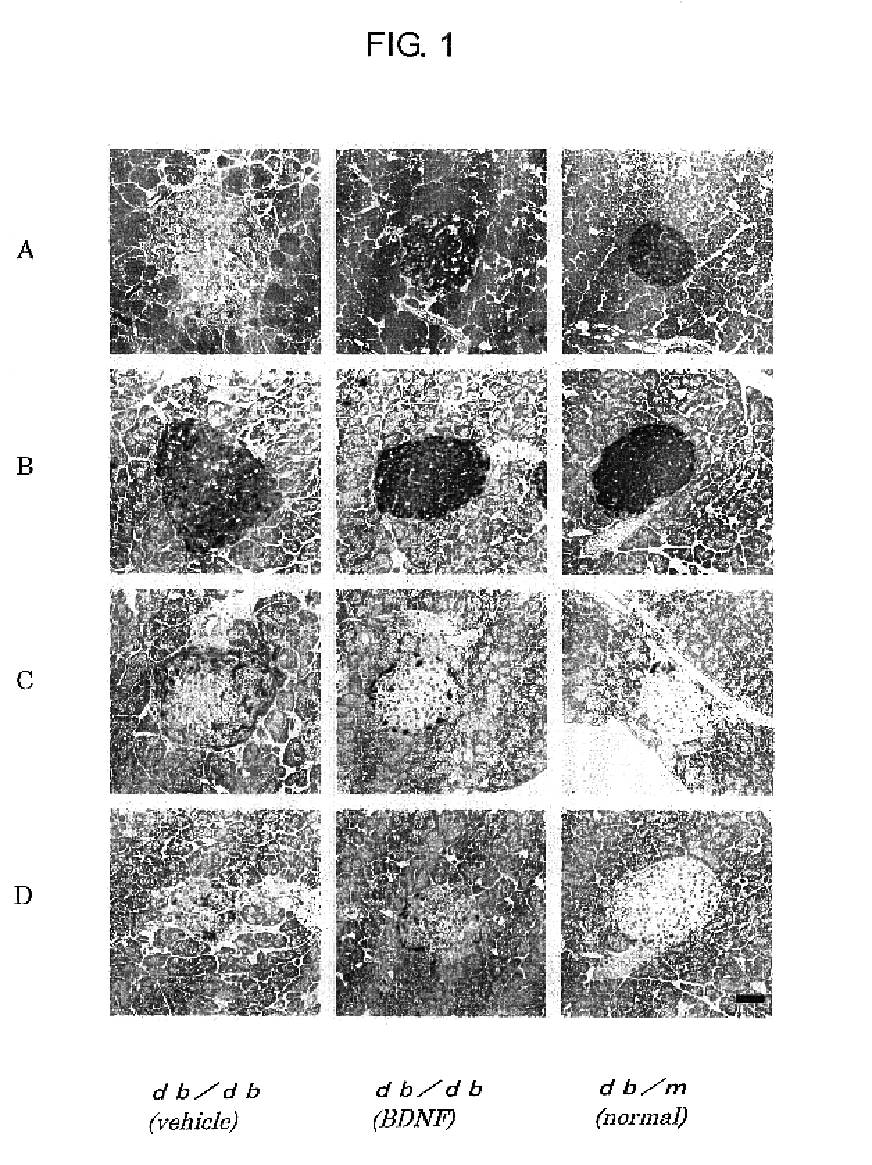 Agent for ameliorating pancreatic function disorder