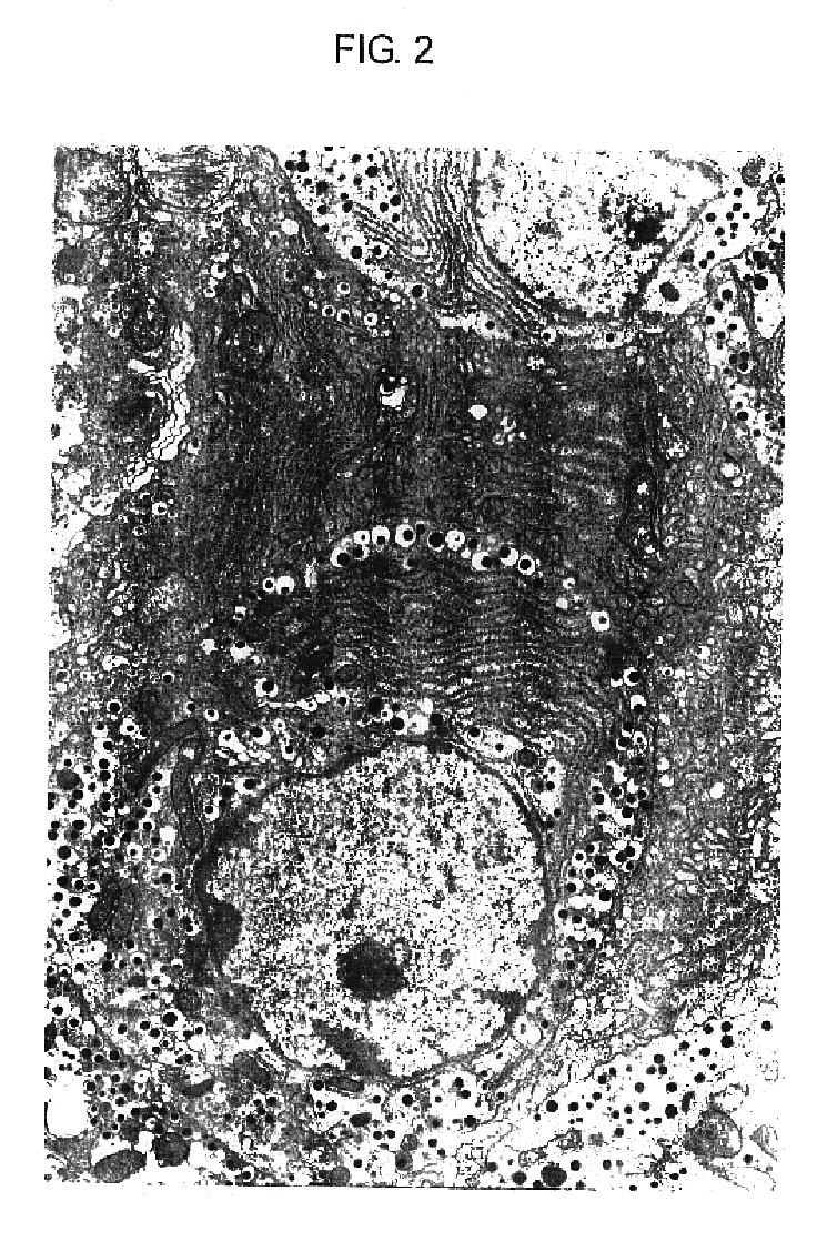 Agent for ameliorating pancreatic function disorder