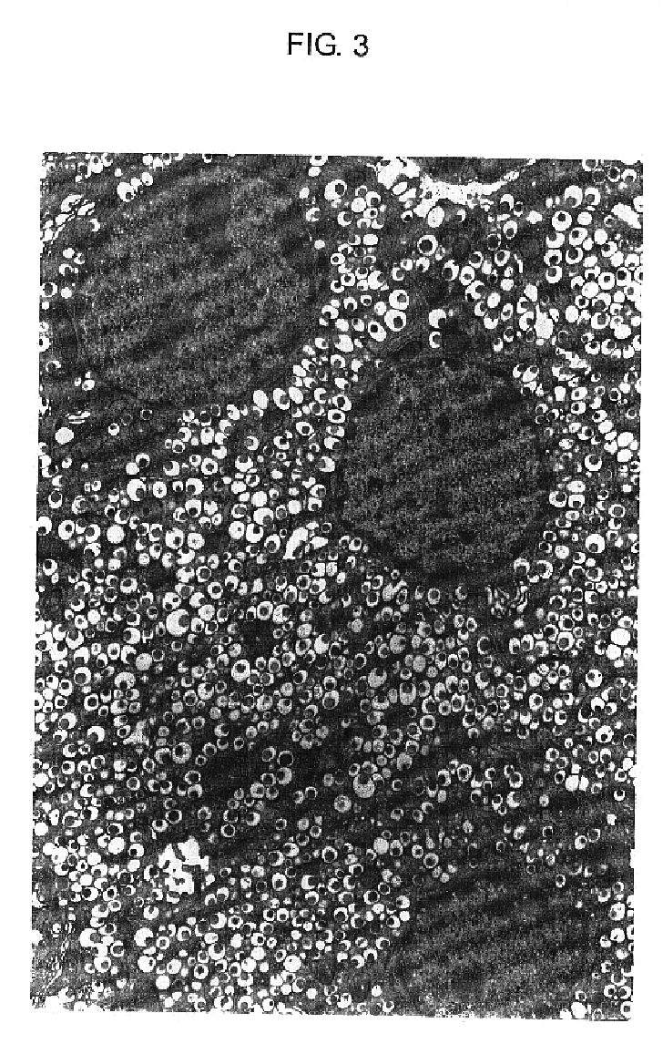 Agent for ameliorating pancreatic function disorder